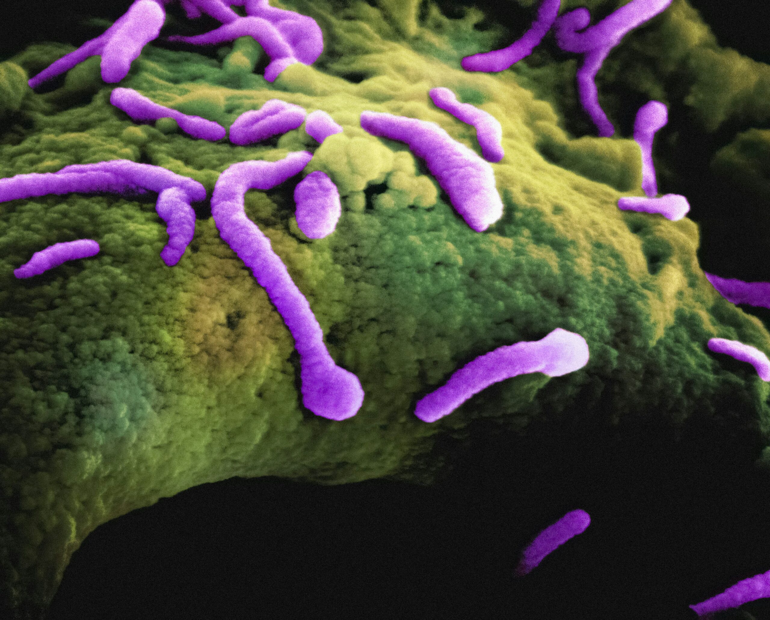 Explosion des infections par des bactéries résistantes aux antibiotiques et effondrement du système de santé à Gaza